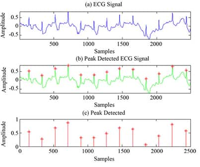 Image of ongoing signal and the peaks from an EKG to measure the heartbeat parameters