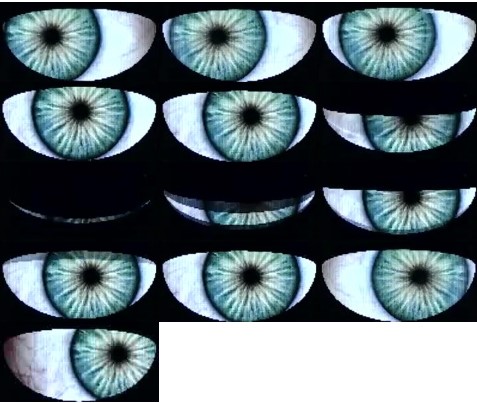 Eye Photos